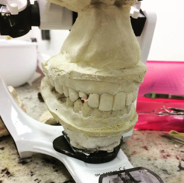 Laboratório de Prótese prórpio